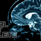 Image for article titled Brain Making Too Much Noise? Reboot It